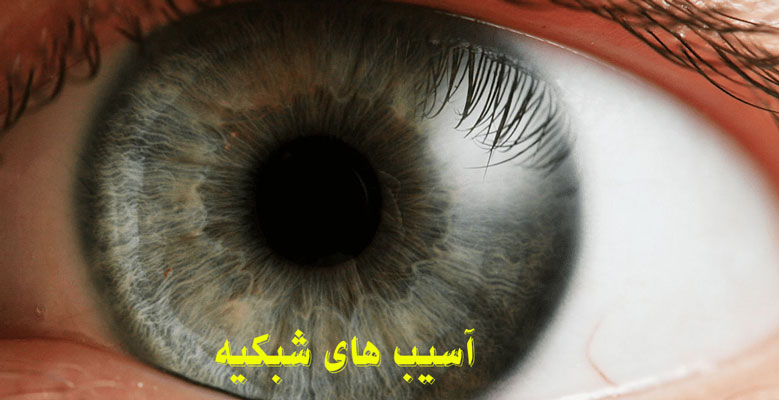 آسیب شبکیه چشم