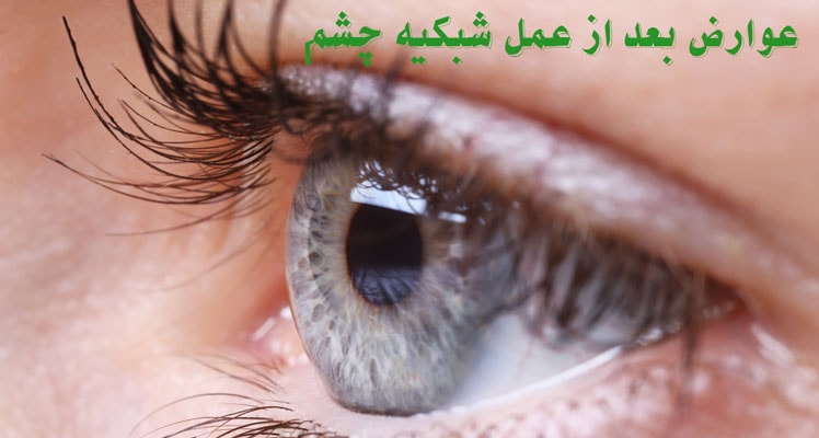 عوارض بعد از عمل شبکیه چشم