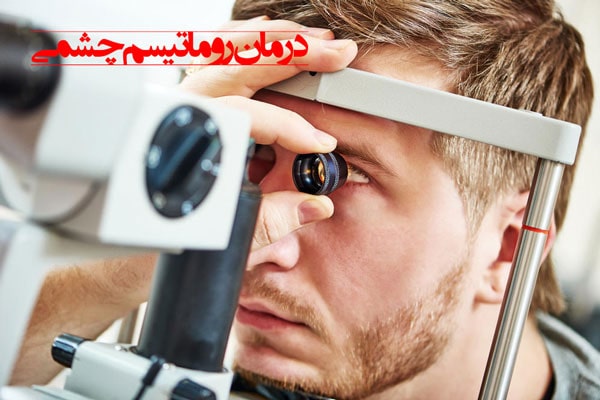 درمان بیماری روماتیسم چشمی