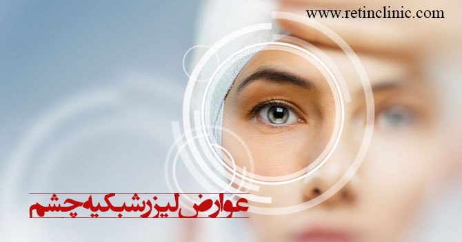 عوارض لیزر شبکیه چشم