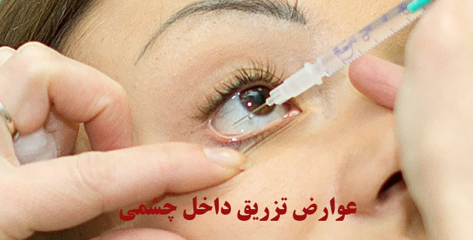 عوارض تزریق چشمی