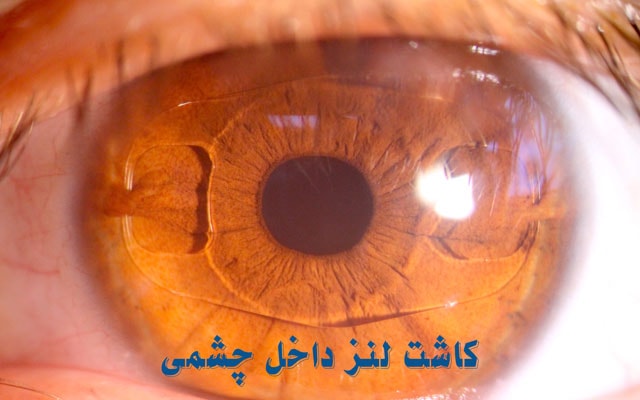 لنز داخل چشمی